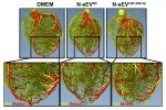 Newsletter Epigenetik: Mikro-RNA-Therapie lässt Herzkranzgefäße wieder sprießen